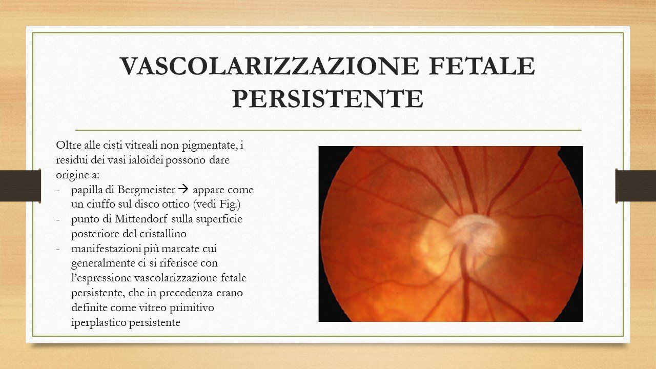 oculista, corsano, carucci, oculista carucci