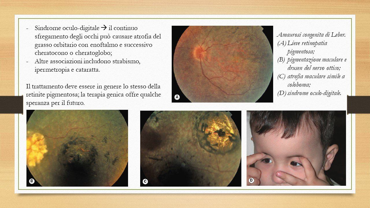 oculista, corsano, carucci, oculista carucci