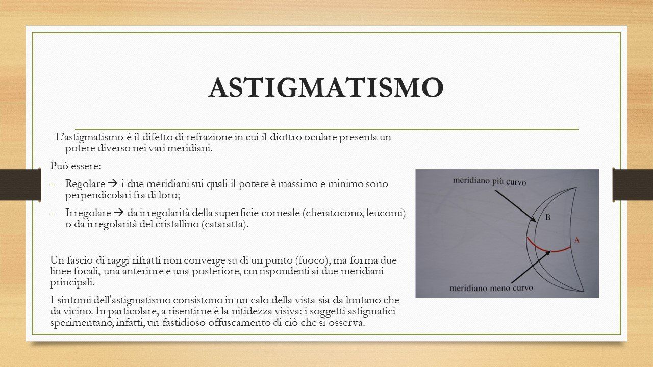 oculista, corsano, carucci, oculista carucci