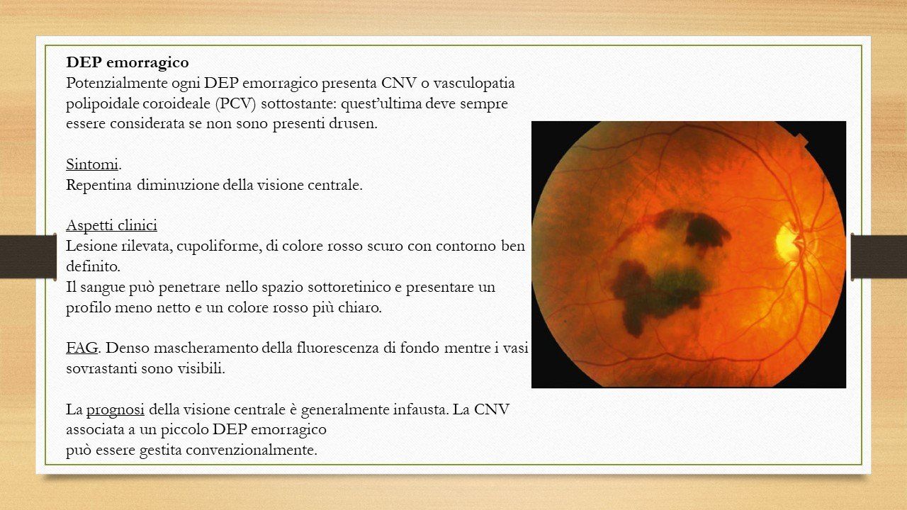 oculista, corsano, carucci, oculista carucci