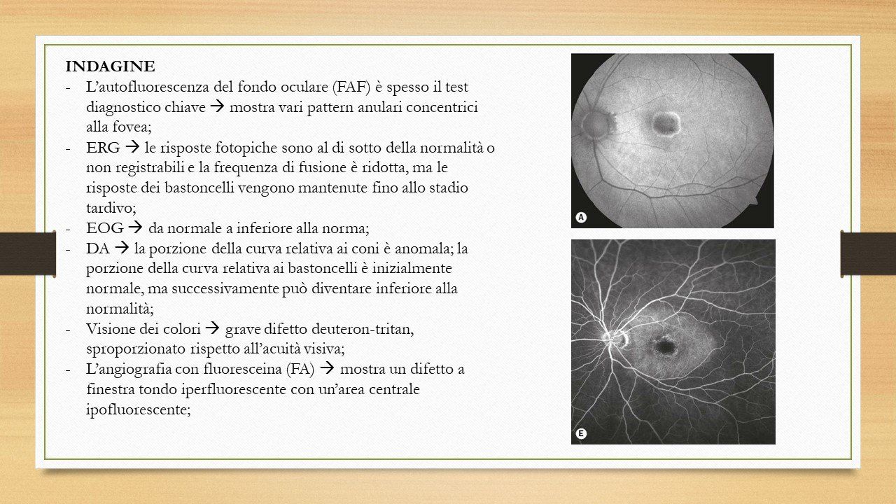 oculista, corsano, carucci, oculista carucci