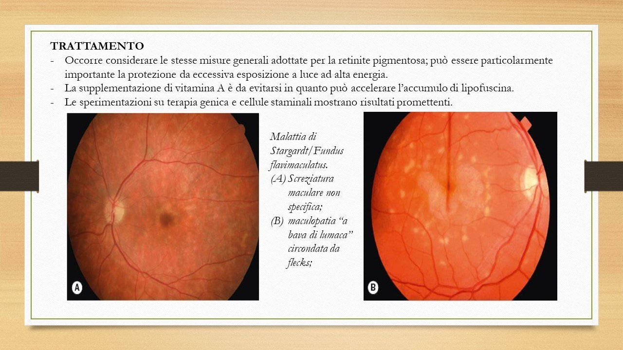oculista, corsano, carucci, oculista carucci
