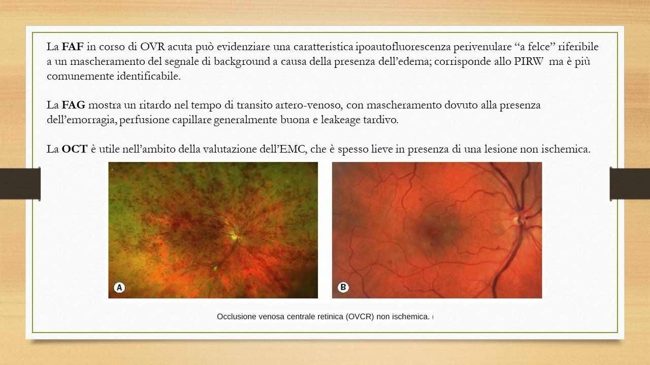 oculista, corsano, carucci, oculista carucci