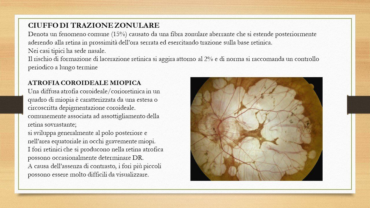 oculista, corsano, carucci, oculista carucci