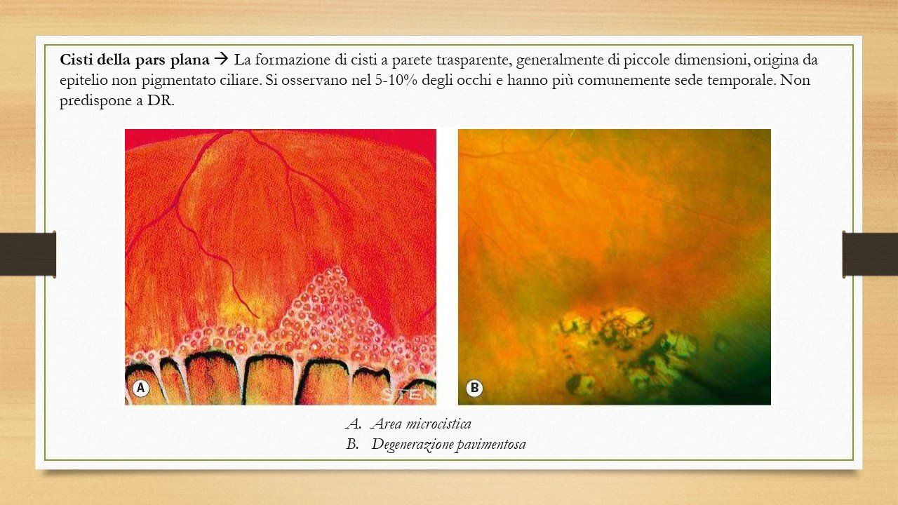 oculista, corsano, carucci, oculista carucci