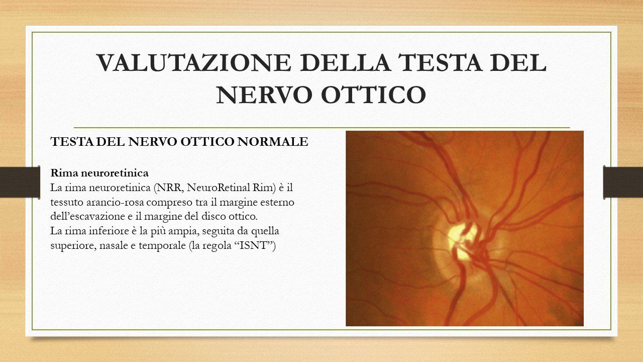 oculista, corsano, carucci, oculista carucci