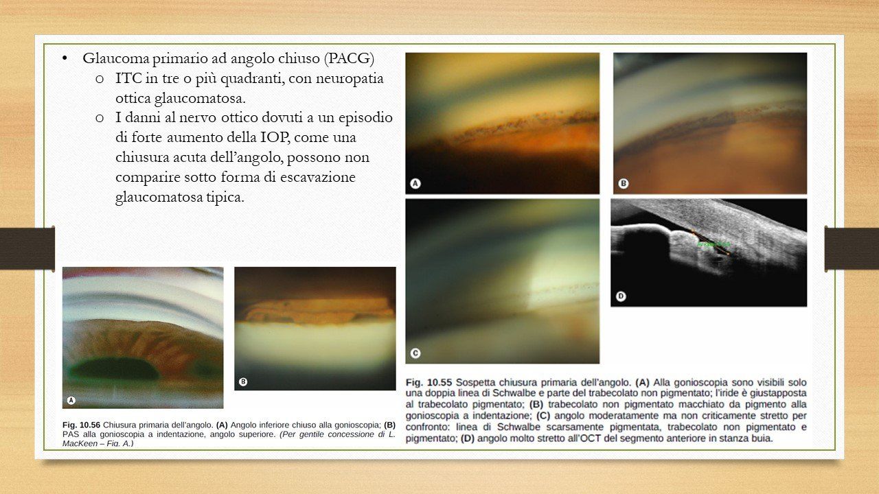 oculista, corsano, carucci, oculista carucci