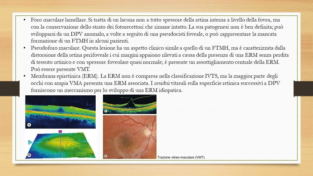 oculista, corsano, carucci, oculista carucci