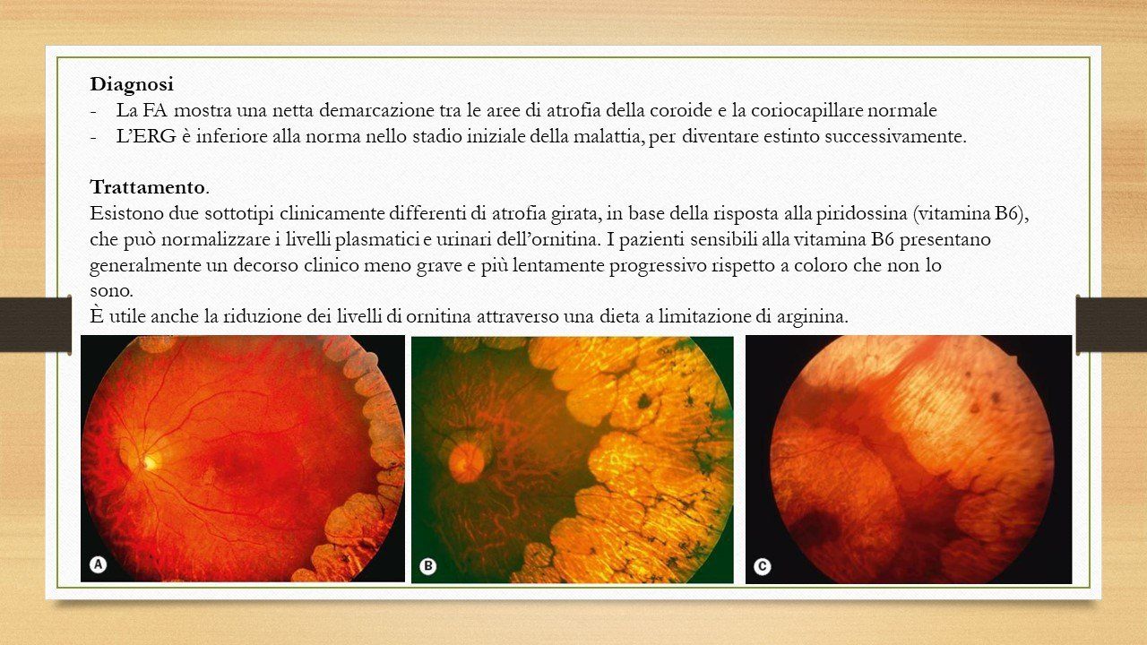 oculista, corsano, carucci, oculista carucci