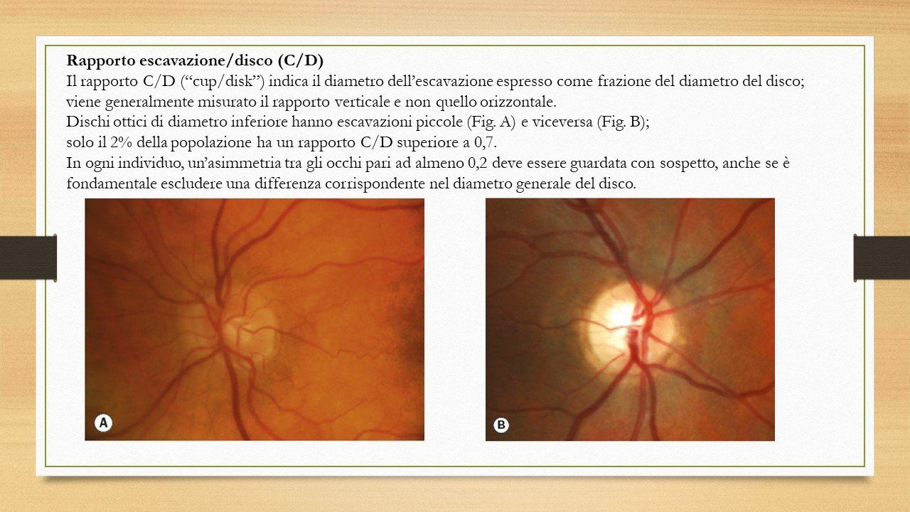 oculista, corsano, carucci, oculista carucci