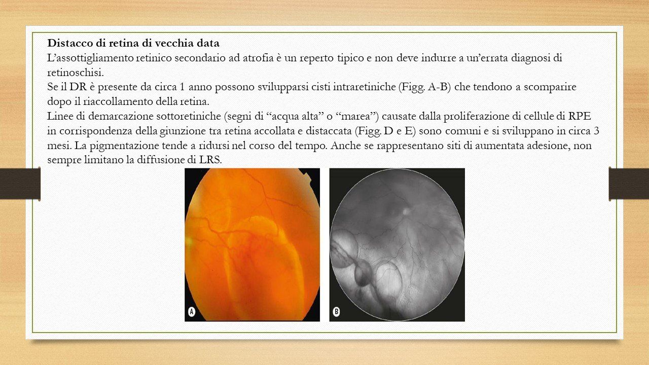 oculista, corsano, carucci, oculista carucci