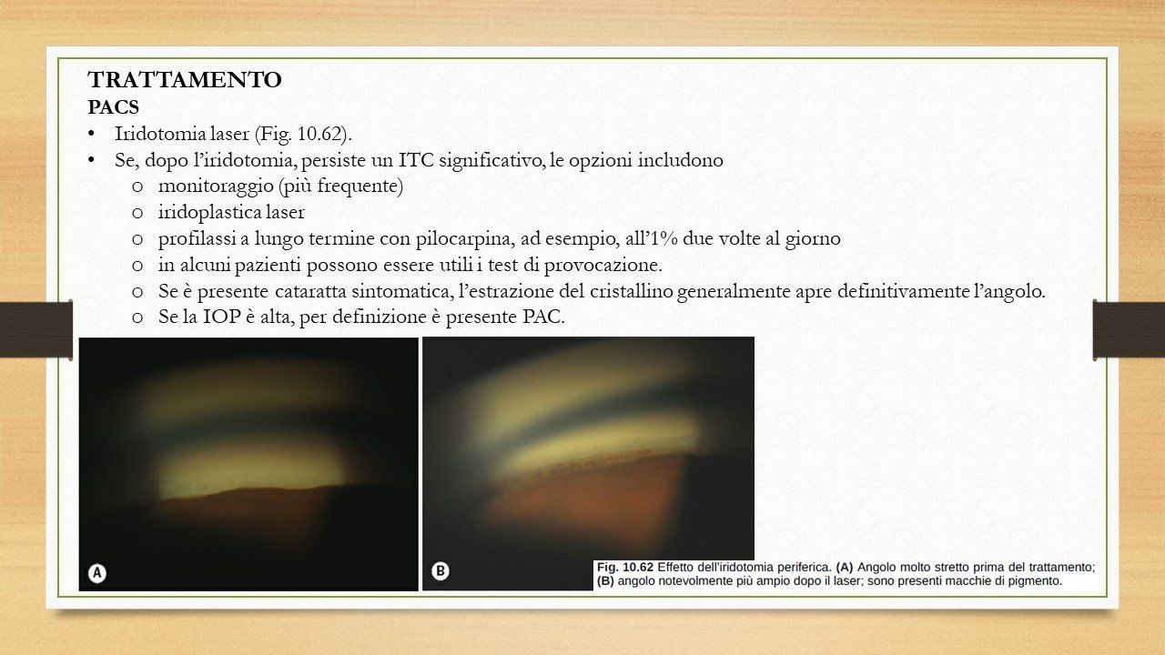 oculista, corsano, carucci, oculista carucci