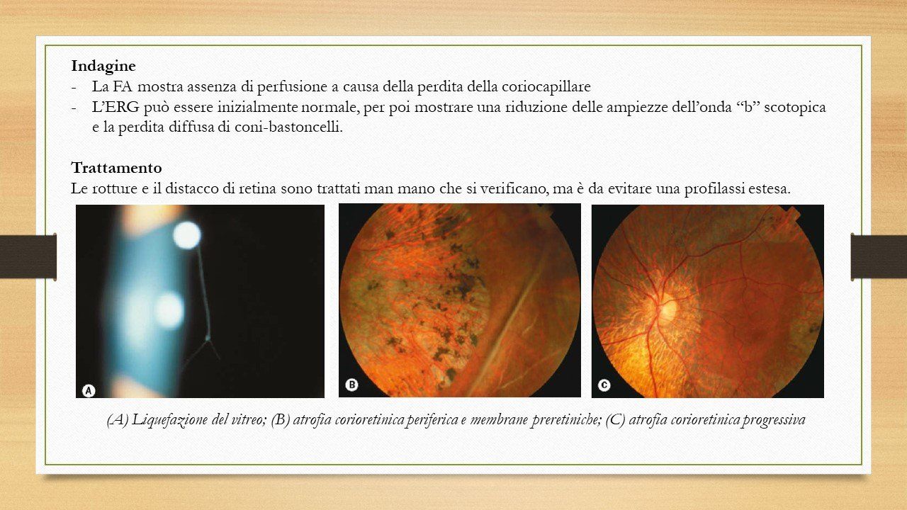 oculista, corsano, carucci, oculista carucci