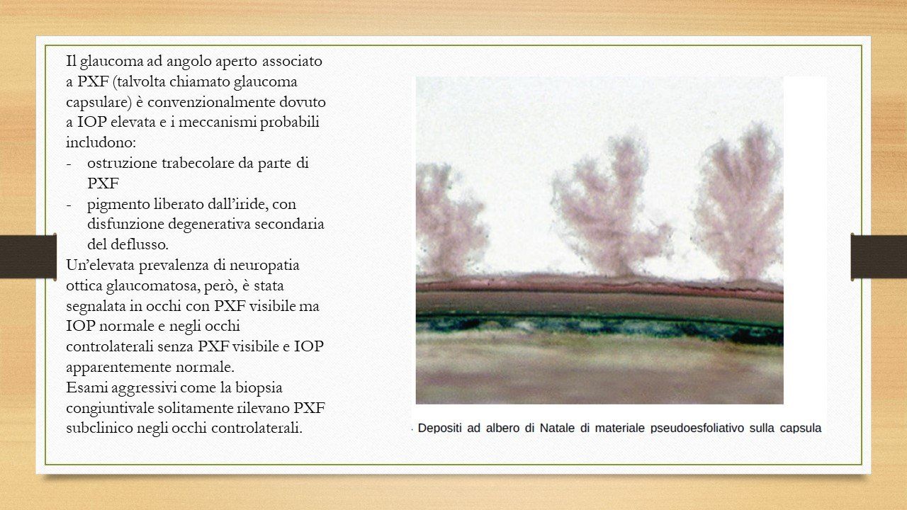 oculista, corsano, carucci, oculista carucci