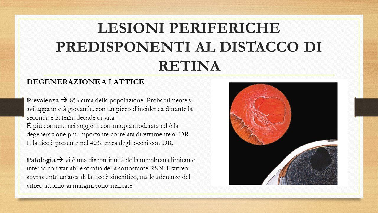 oculista, corsano, carucci, oculista carucci