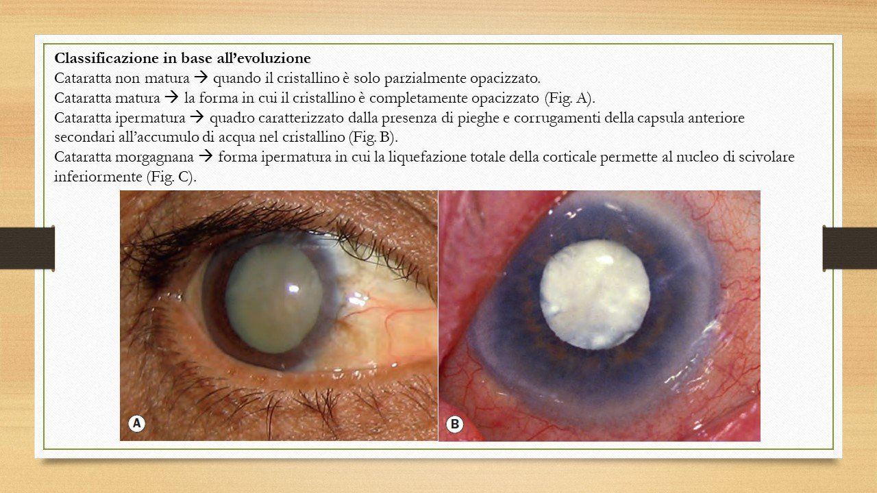 oculista, corsano, carucci, oculista carucci