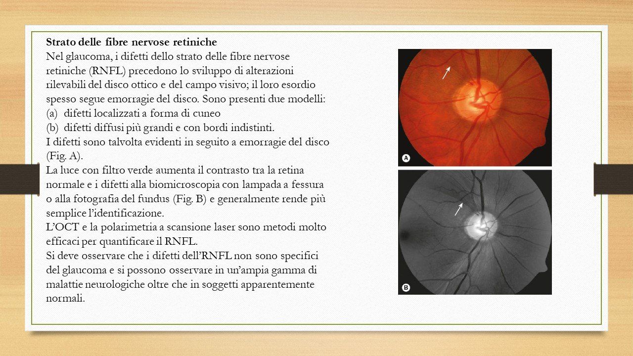oculista, corsano, carucci, oculista carucci