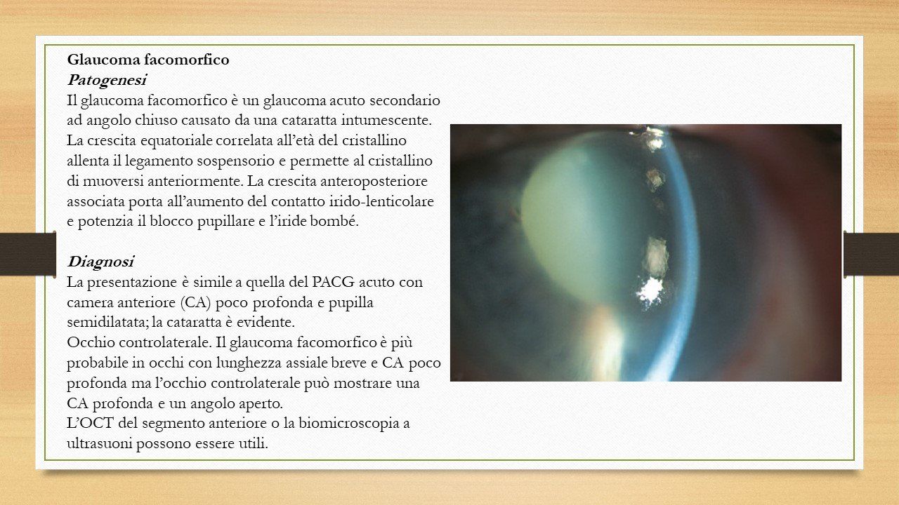 oculista, corsano, carucci, oculista carucci