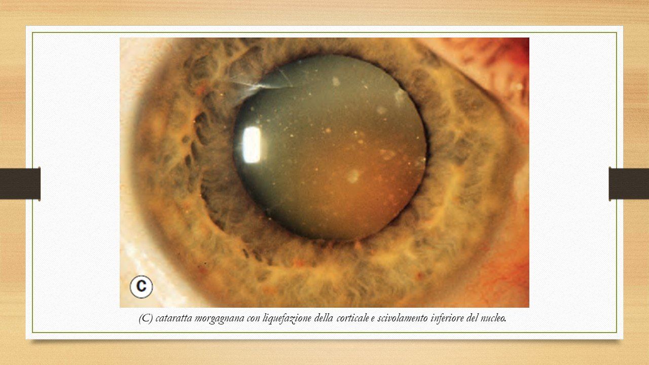 oculista, corsano, carucci, oculista carucci