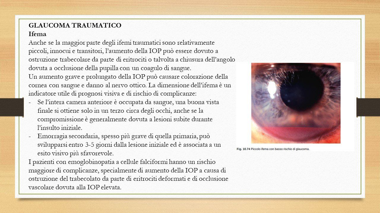 oculista, corsano, carucci, oculista carucci