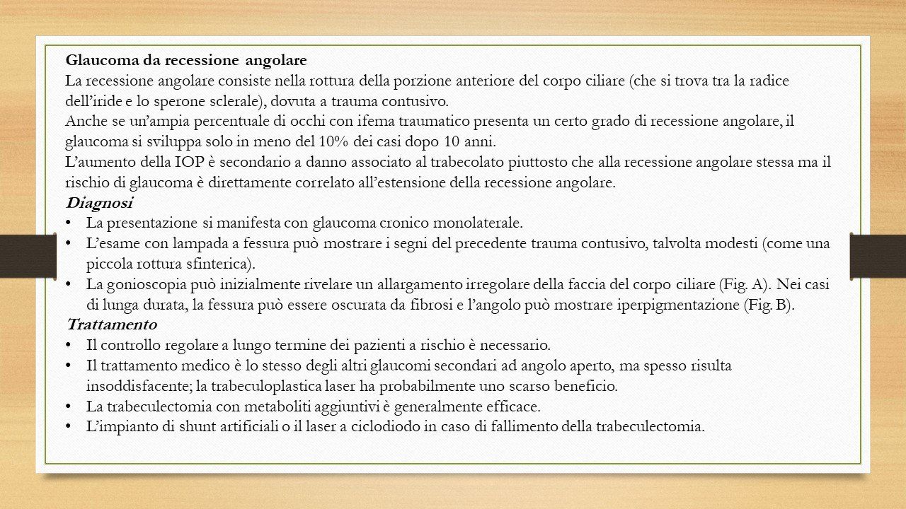 oculista, corsano, carucci, oculista carucci