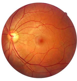 retinografia, macula, maculopatia, retina, oculista, corsano, carucci, oculista carucci