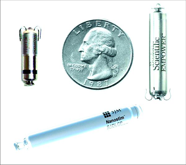 First implant of dual-chamber leadless pacemaker: Abbott sets world record
First implant of dual-chamber leadless pacemaker: Abbott sets world record