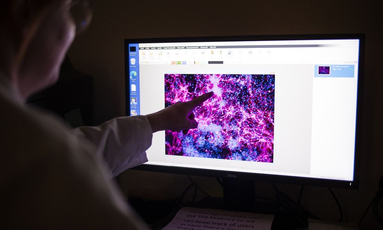 World’s first personalized DNA editing treatment, world record in Philadelphia, Pennsylvania World’s first personalized DNA editing treatment, world record in Philadelphia, Pennsylvania