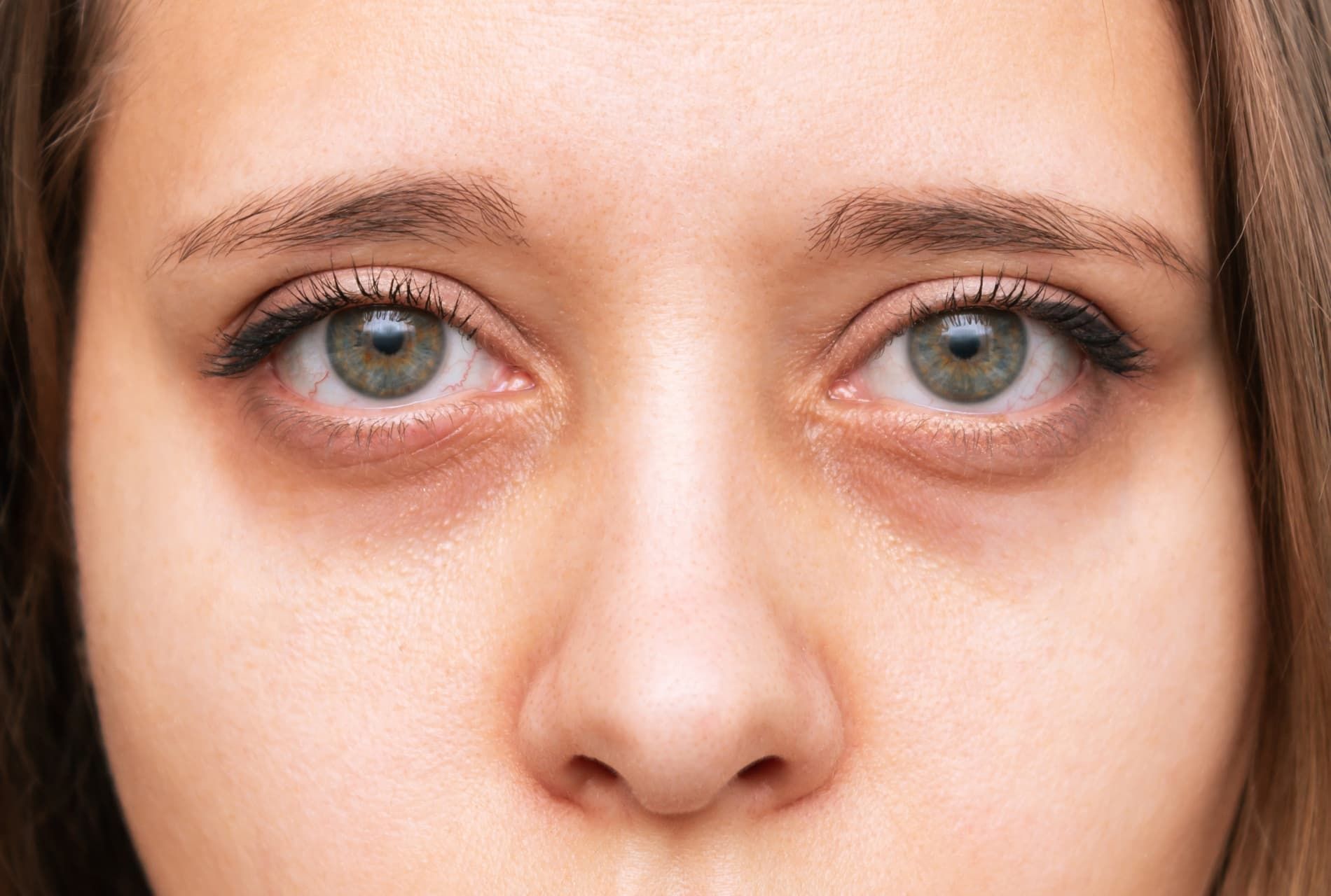 regard-femme-cernes