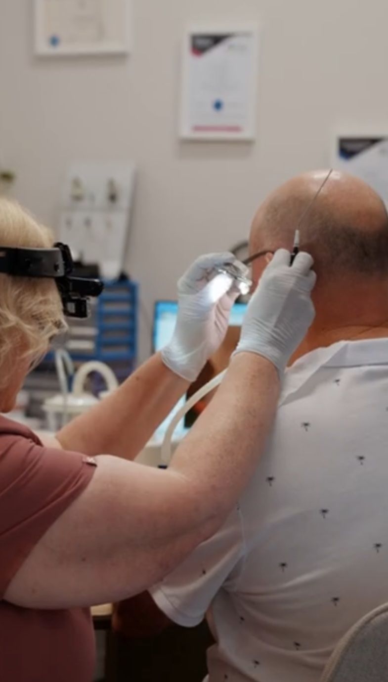 Healthcare worker trims a patient's ear hair with electric clippers during a clinical visit — Local Hearing Aid Specialists in Wallsend, NSW