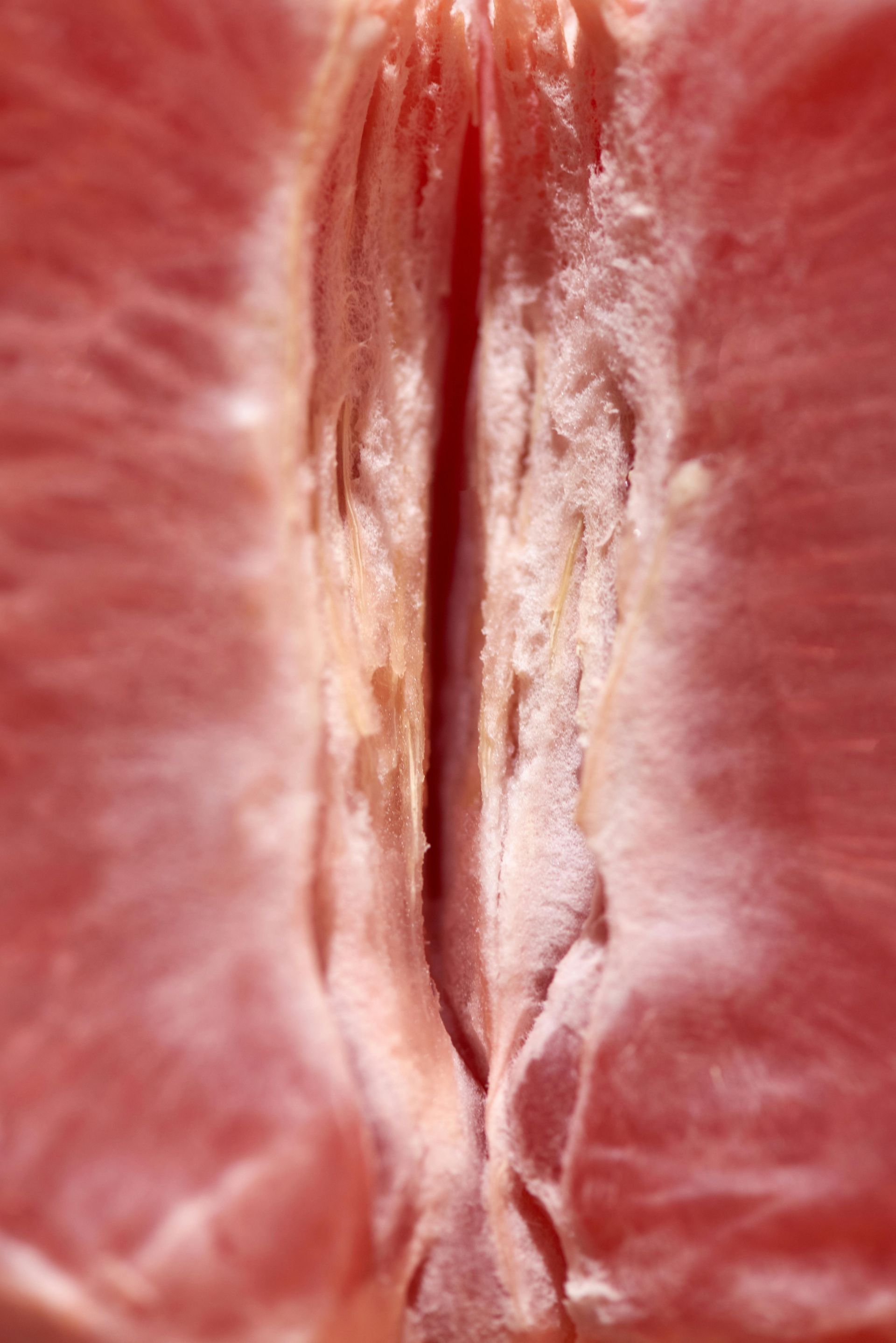 Perineoplastia: a cirurgia íntima que pouca gente fala, mas pode mudar tudo
