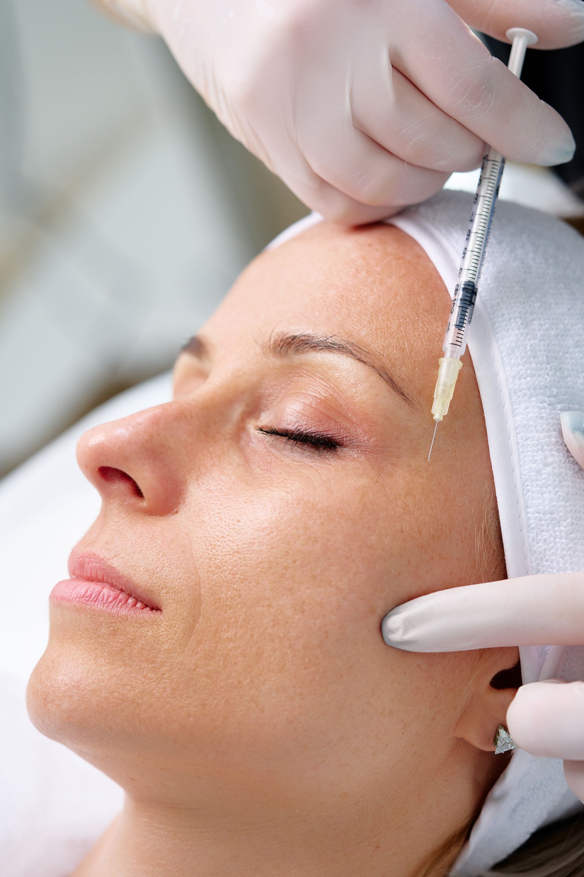 Cosmetic procedure on face with gloved hands using a syringe near the forehead