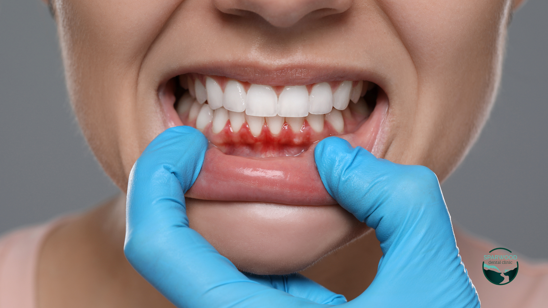 The Surprising Connection Between Oral Health and Your Immune System