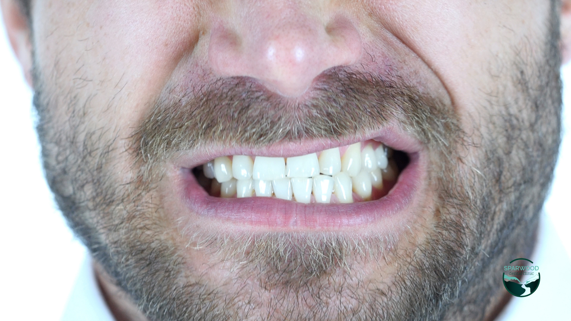 A man with a beard is making a funny face with his mouth open.
