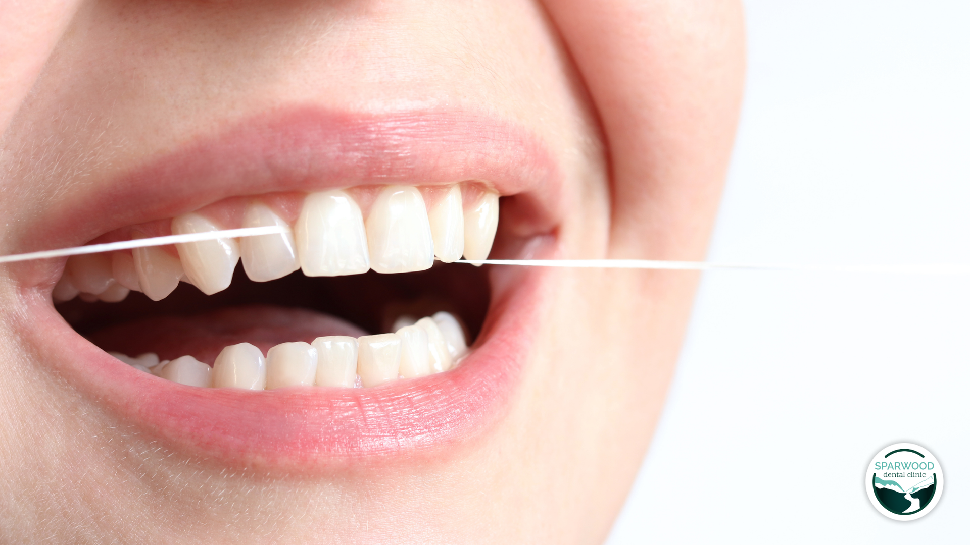 Mouth flossing with white dental floss, close-up. Shows healthy white teeth.