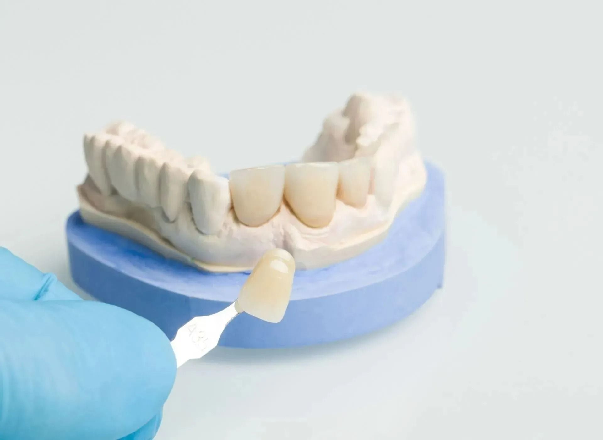 Blue-gloved hand applying dental material to a model jaw with a small spatula