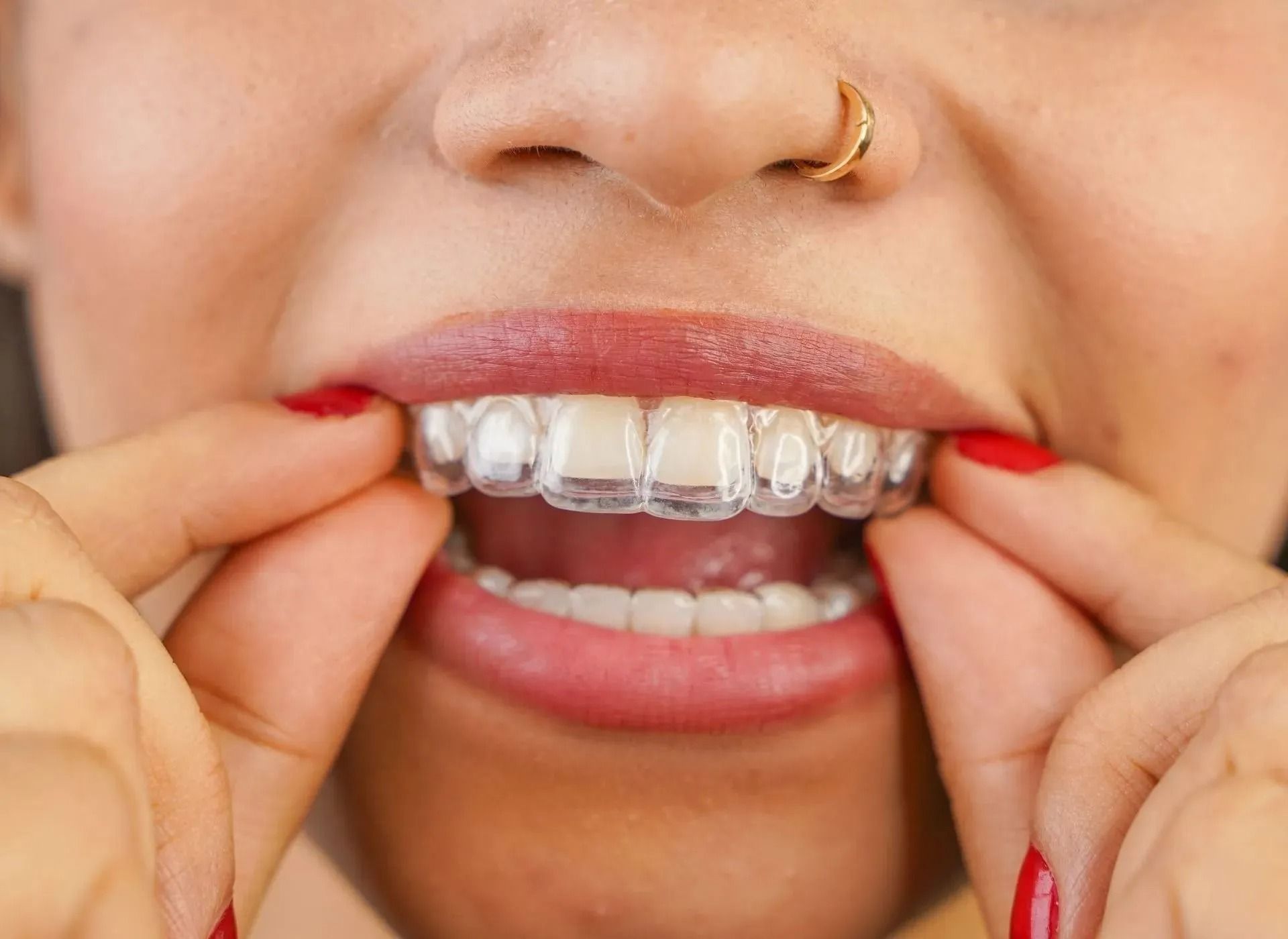 Person adjusting clear braces on teeth with hands, wearing red nail polish and a gold nose ring
