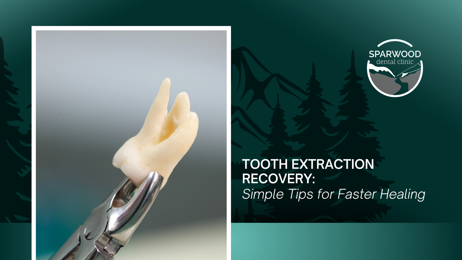 Tooth extraction recovery graphic with extracted tooth in forceps and text on faster healing tips