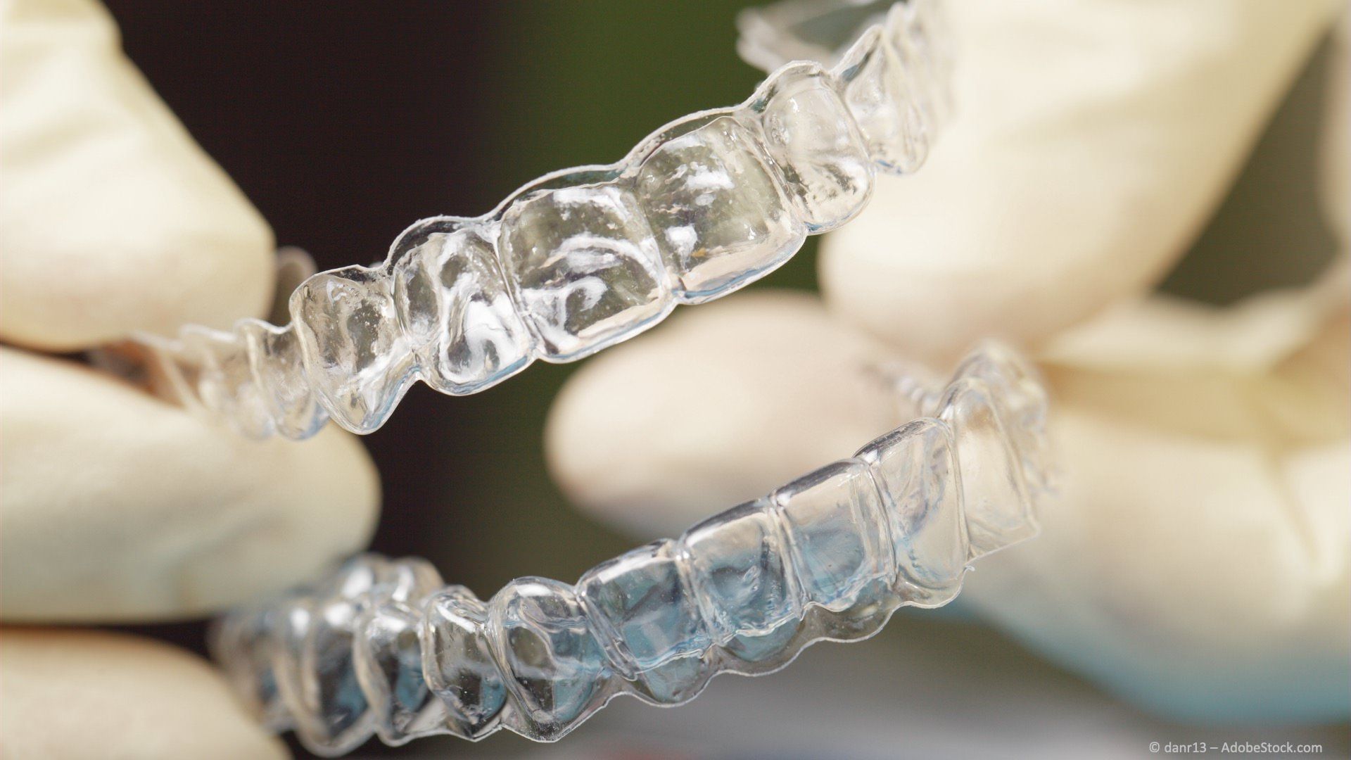 Retainer aus Kunststoff