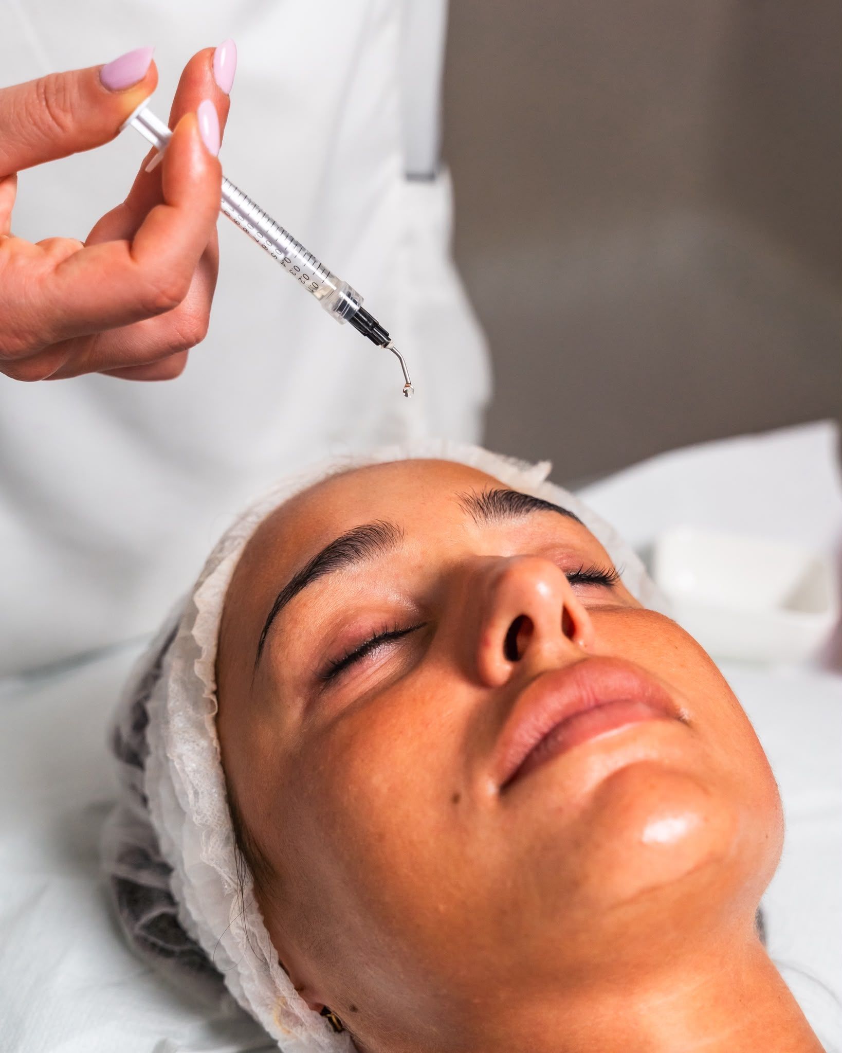 Durante un trattamento estetico del viso, una siringa inietta del liquido nella fronte di una donna.