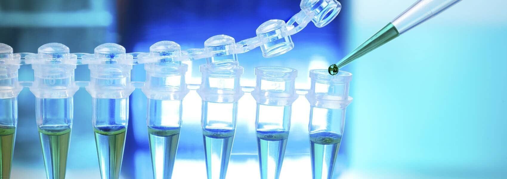 LABORATORIO MATRIZ - antígeno prostático