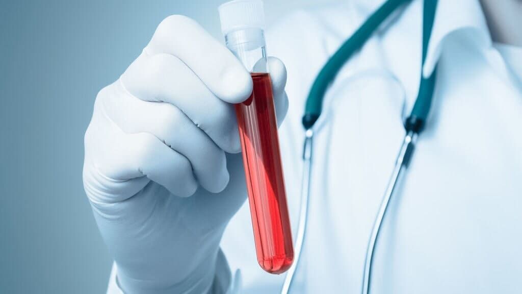LABORATORIO MATRIZ - muestras de sangre