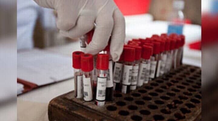 LABORATORIO MATRIZ - análisis bioquímicos