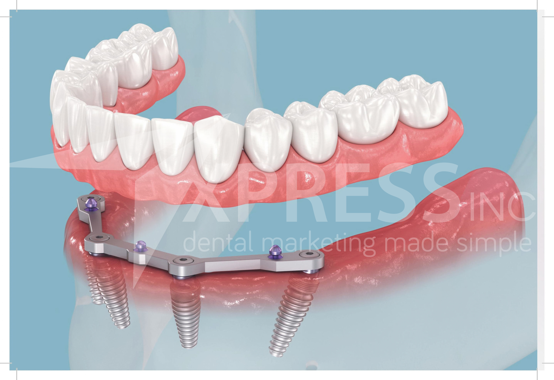 A dental promotion by Smiles by Design, featuring a $149 diagnostic visit, contact info, and office location in Syracuse, NY.