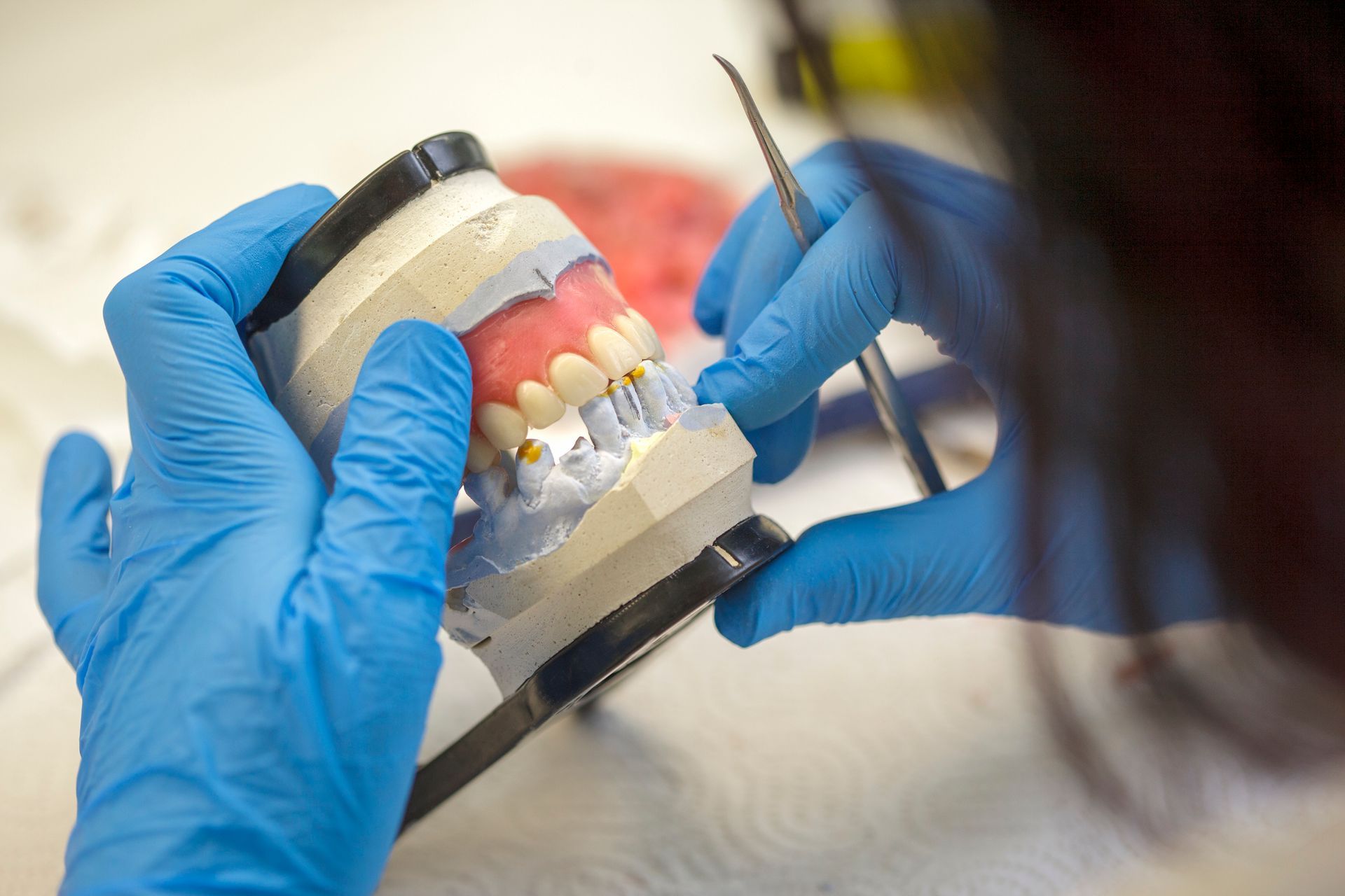 A person wearing blue gloves is working on a model of teeth.