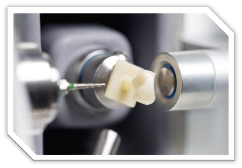 Glidewell — Rochester, MN — Broadway Dental Care
