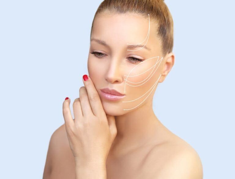 Woman's face with surgical lift lines drawn on, highlighting areas for tightening.