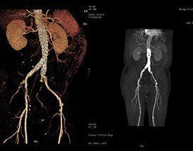 Un scanner d'un rein et un scanner d'une aorte.