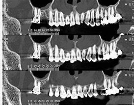 Une photo en noir et blanc des dents d'une personne.