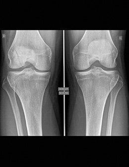 Radiographie